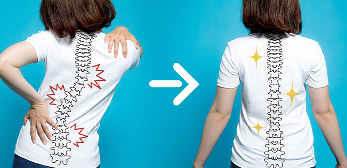chiropractic for good posture in Monterey Park, CA