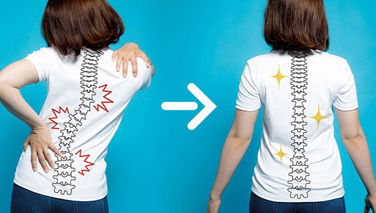 chiropractic for good posture in Monterey Park, CA