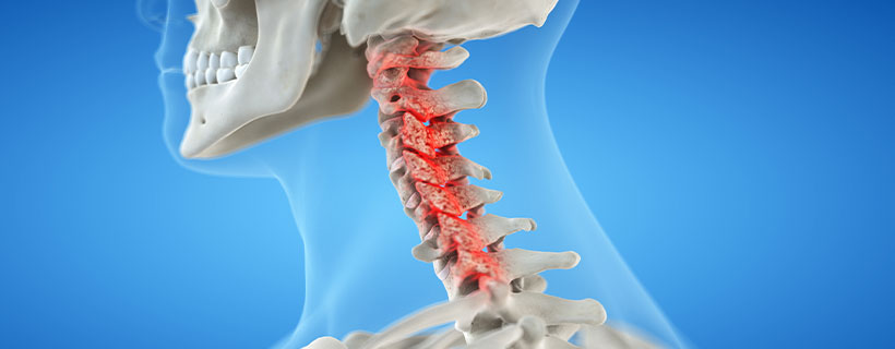 patient needing bone spur treatment in Monterey Park