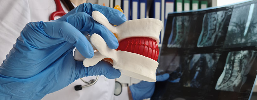 patient needing herniated disc treatment in Monterey Park