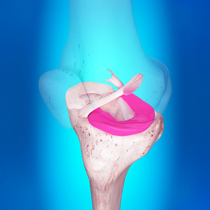 ligamentitis chiropractor in Monterey Park, CA