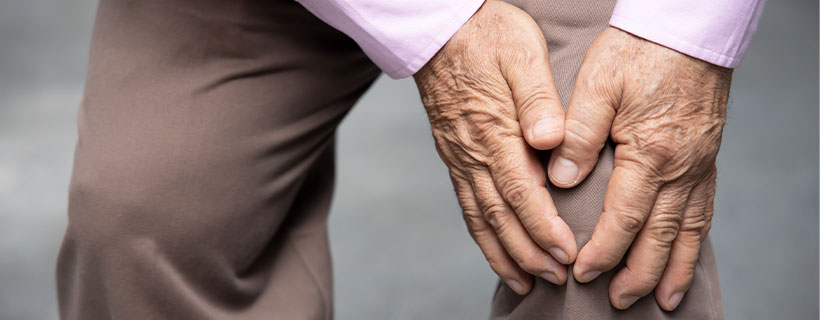 patient needing osteoarthritis treatment in Monterey Park