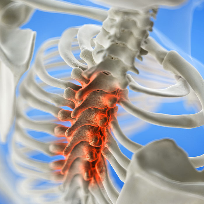 spinal stenosis treatment in Monterey Park, CA